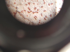 Arthonia rubrocincta