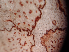 Arthonia rubrocincta