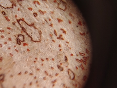 Arthonia rubrocincta