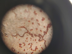 Arthonia rubrocincta