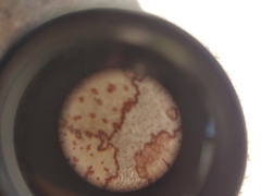 Arthonia rubrocincta