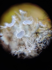 Heterodermia echinata