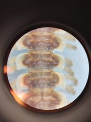 Pseudopolydesmus erasus