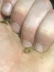 Pristimantis altamnis