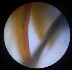 Anoectangium aestivum