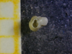 Quinqueloculina