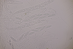 Menispora glauca