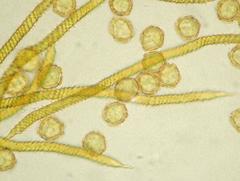 Oligonema persimile