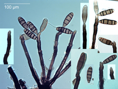 Nigrolentilocus variabilis