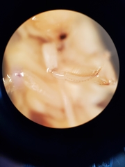 Corisella