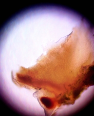 Bacidia polychroa
