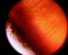 Bacidia polychroa