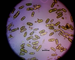Microcalicium disseminatum