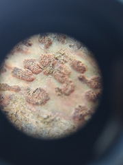 Bathelium carolinianum