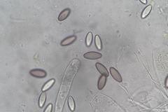 Ascobolus hawaiiensis