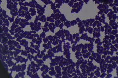 Staphylococcus aureus