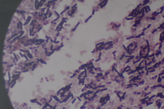 Bacillus subtilis