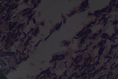 Bacillus subtilis