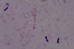 Bacillus