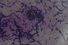 Bacillus