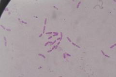 Escherichia coli