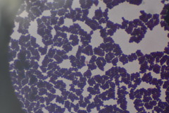 Staphylococcus aureus