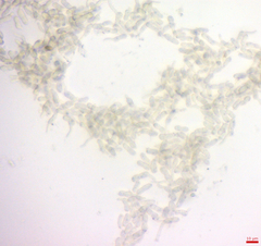 Puccinia stipae