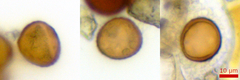 Puccinia stipae