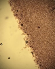 Stereostratum corticioides