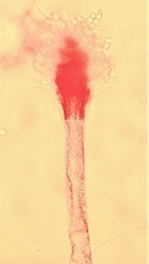 Gloiosphaera