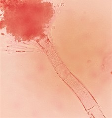 Gloiosphaera