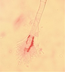 Gloiosphaera