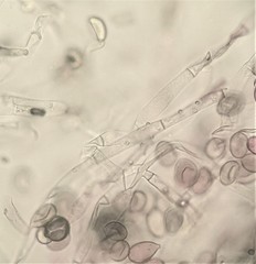 Botryobasidium