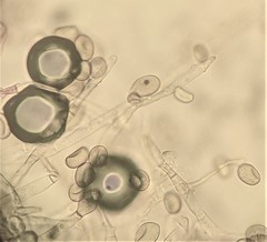 Botryobasidium