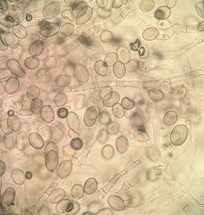 Botryobasidium