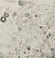 Chromelosporium