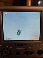 Pseudoplectania vogesiaca