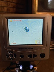 Pseudoplectania vogesiaca