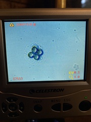 Pseudoplectania vogesiaca