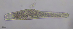 Spirostomum teres