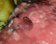 Asteracmea suteri