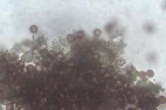 Didymium squamulosum