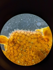 Bryozoa