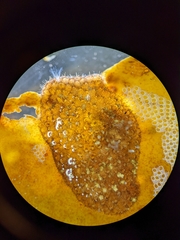Bryozoa