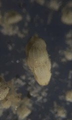 Uvigerinidae