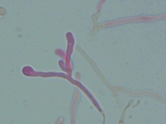 Ceriporia bresadolae