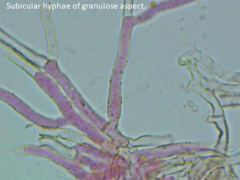 Ceriporia bresadolae