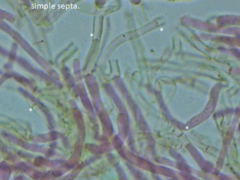 Ceriporia bresadolae