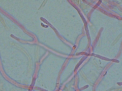 Ceriporia bresadolae