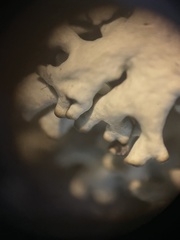 Xanthoparmelia wyomingica